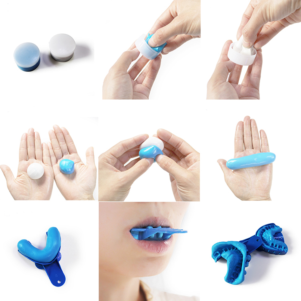 Dental Impression Material Kit - Luxsmile Dental Klinische Eindruck Kit Material