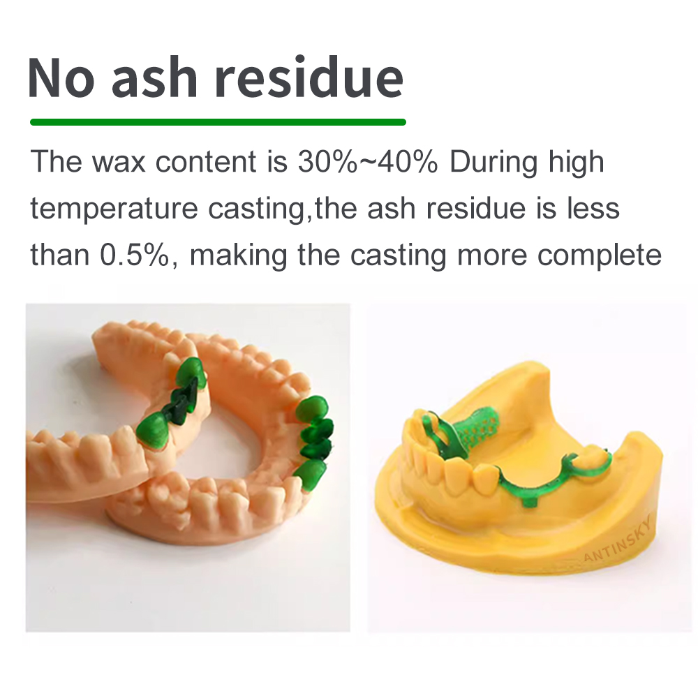Antinsky Gießbares Dental-Smar – Dental 3D Printer Resin Bewertung und Preis